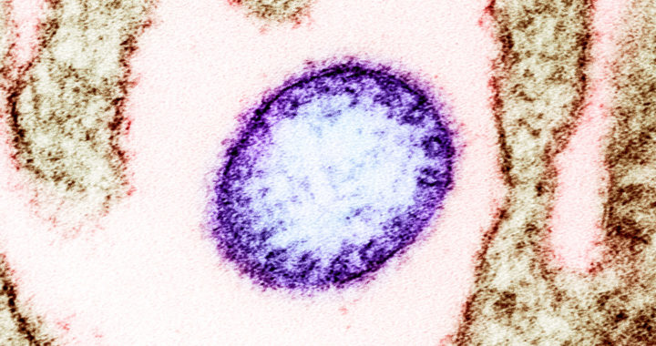 How the Nipah Virus Affects the Human Body