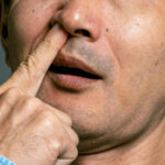 The Potential Link Between Nose-Picking and Alzheimer’s Disease