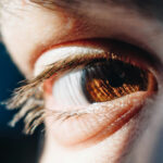 Studies on Lasik: Advantages and Disadvantages