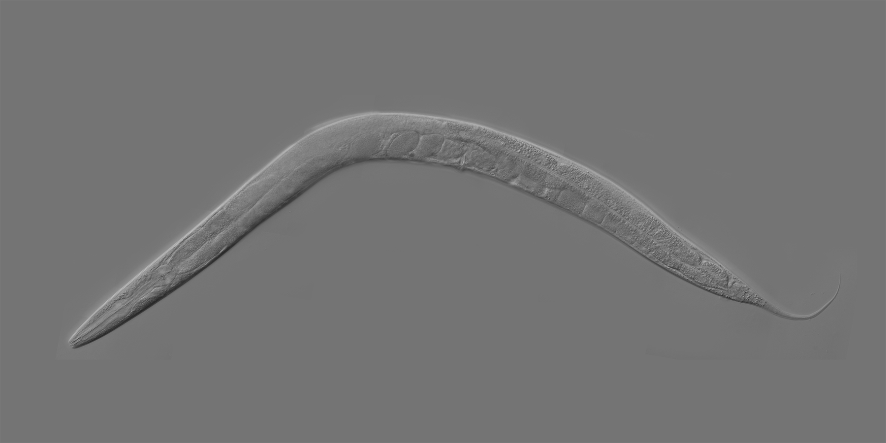 How Tiny Worms Are Becoming Avatars for Human Patients in Drug Research ...